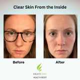 Innate Skin – gélules visibles, usage quotidien pour la clarté de la peau.