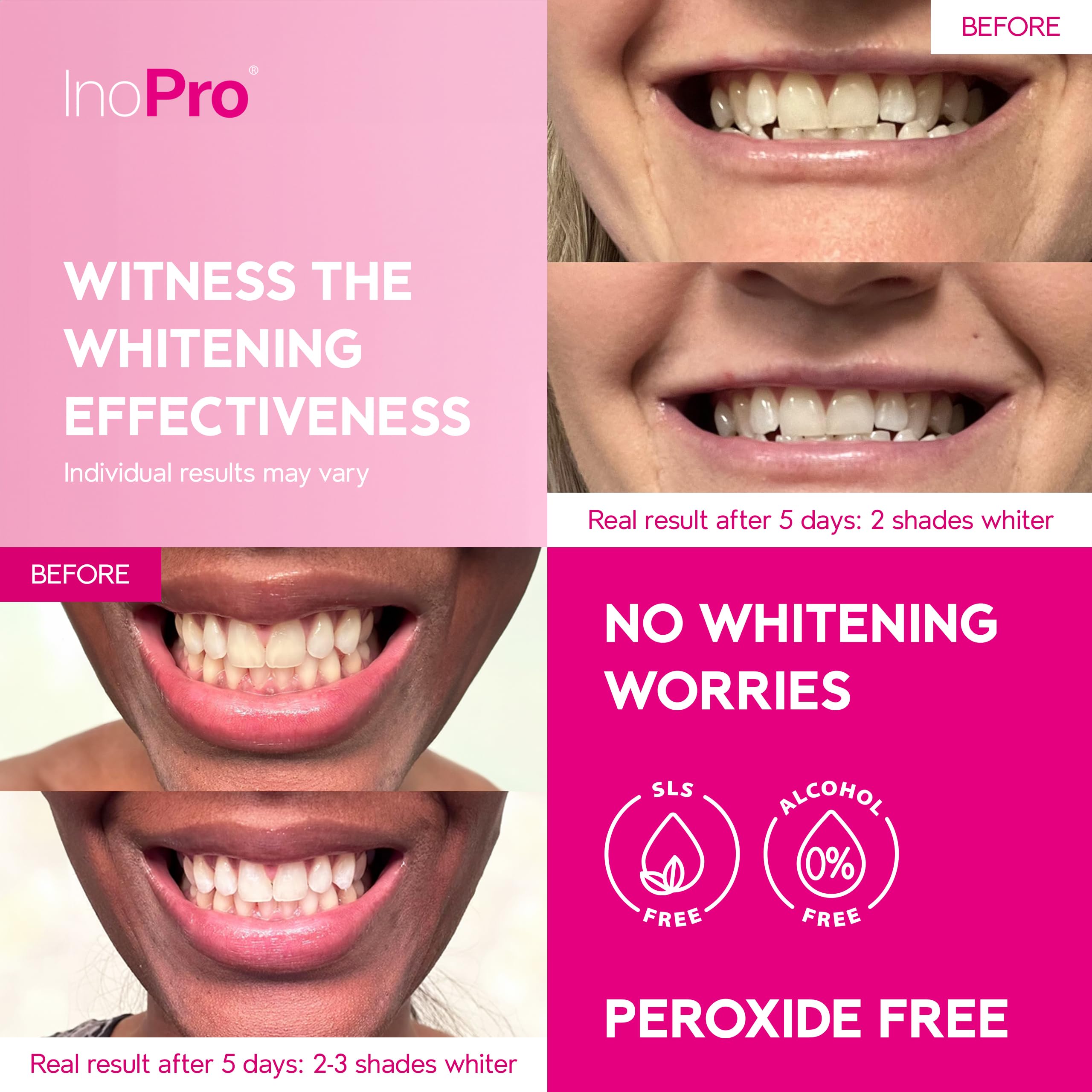 InoPro extraits vegetaux arbutine et huile coco rafraîchir les dents