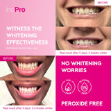 InoPro extraits vegetaux arbutine et huile coco rafraîchir les dents