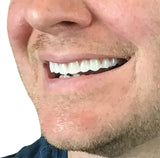 Instant Smile Comfort Fit Flex – Veneer supérieur, teinte claire, confort optimal pendant l’usage.