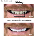 Instant Smile Comfort Fit Flex – Veneer supérieur, teinte claire, solution esthétique portable et discrète.