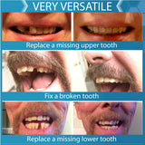 Instant Smile-dent-temporaire-haut-bas : remplacement rapide d'une dent supérieure ou inférieure.