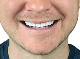 Instant Smile Flex 2pk – ajustement simple pour un alignement discret