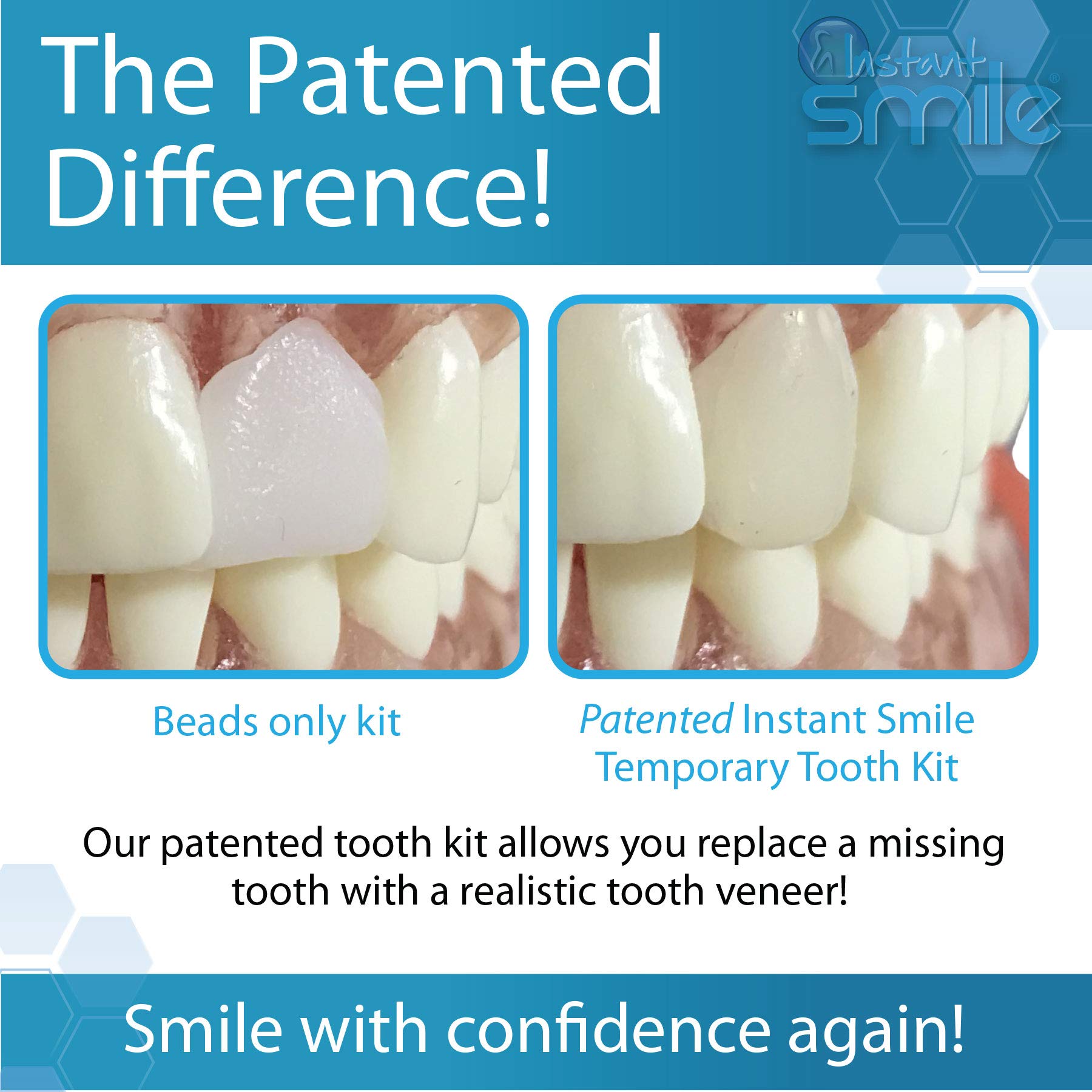 Instant Smile-outils-dent : mise en forme facile pour un ajustement confortable.