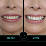 Intelliwhite ProStrips dent blanchiment ciblé avec parfum menthe.