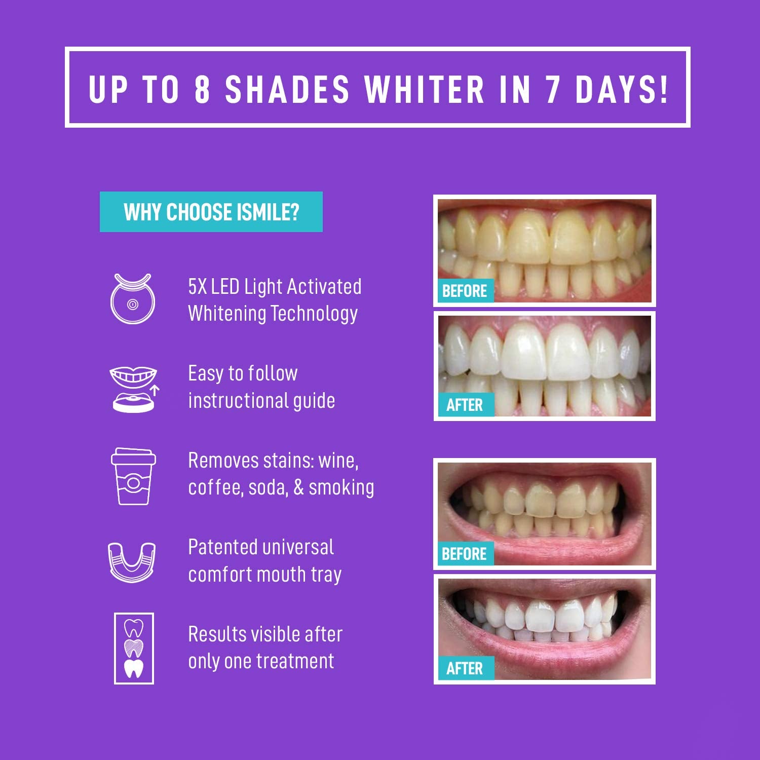 iSmile Whitening – seringues de gel 3ml pour une application précise