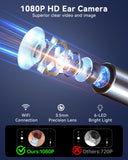 JEGOAT imagerie oreille en temps réel sur smartphone.