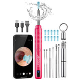 JEGOAT otoscope 1296P: image nette pour repérer les détails en toute sécurité.