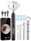 JEGOAT otoscope caméra 1296P pour vision claire dans l'oreille