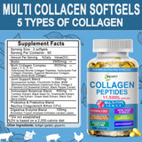 JINGYAT Collagène Softgels biotine pour cheveux et ongles