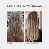 JSHealth Iode et Zinc — composants essentiels pour cheveux et peau.