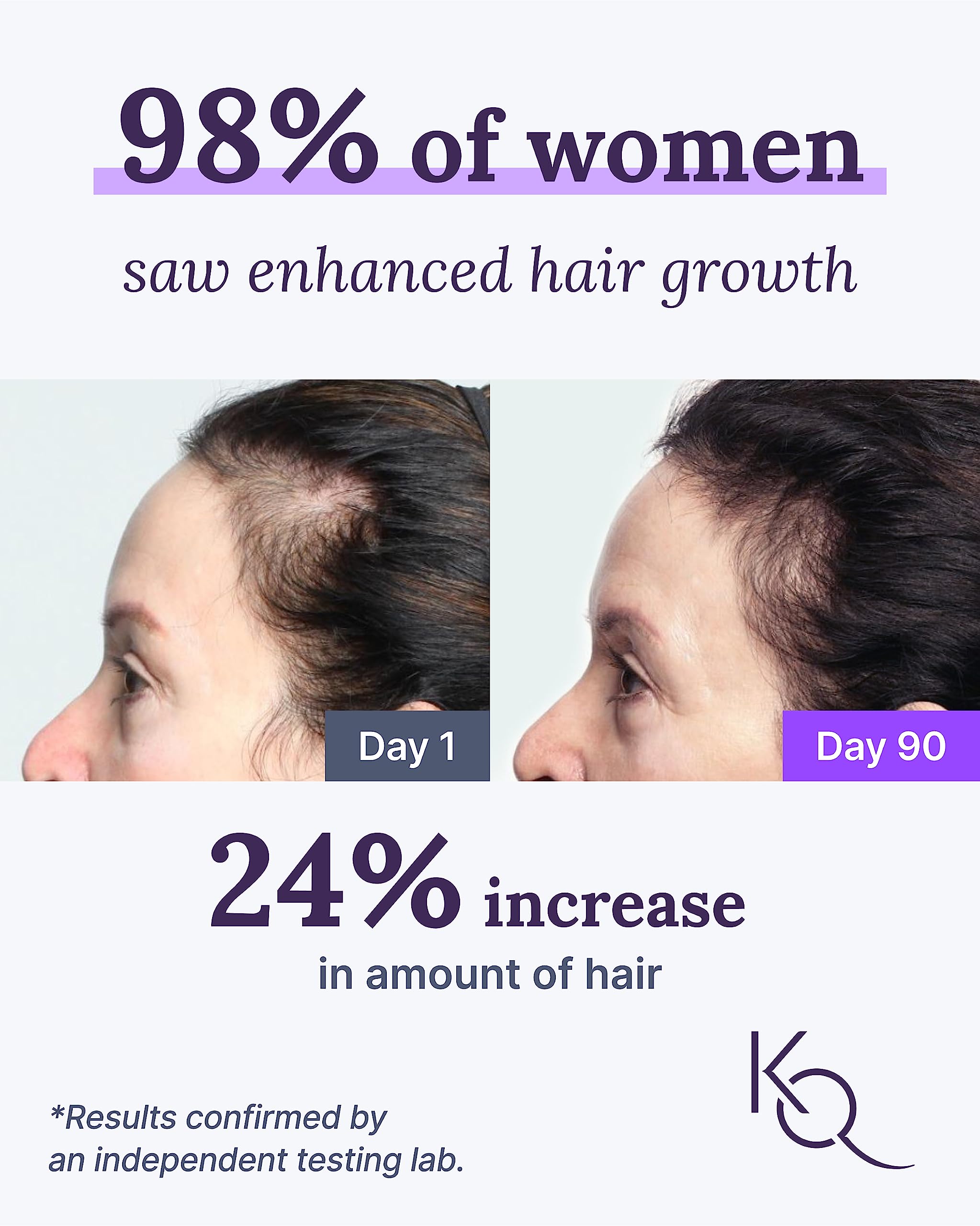 Keranique KeraViatin : bouteille de capsules molles, intégration facile à la routine capillaire.