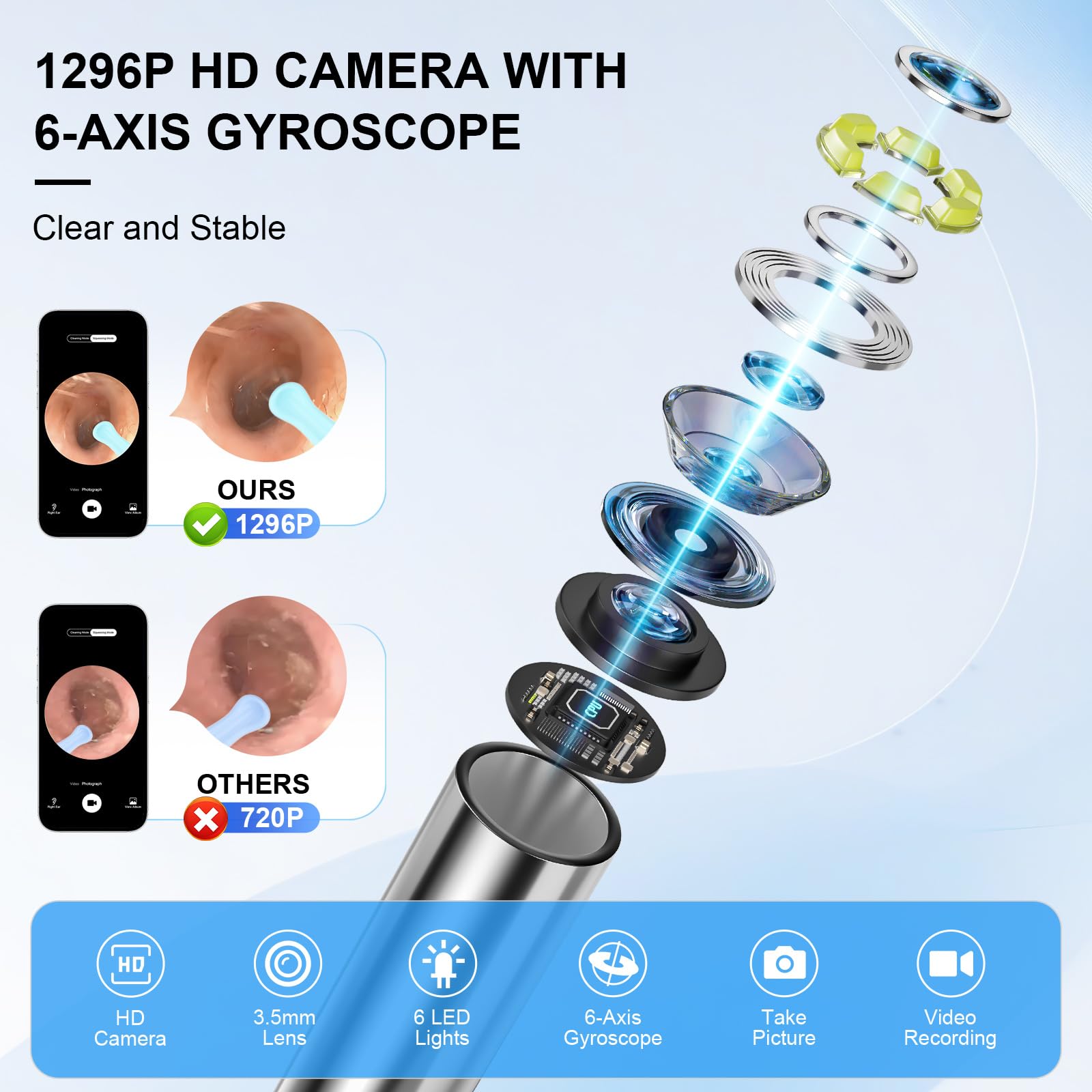Keyloland camera oreille 1296p et vue 360 pour inspection complète du conduit auditif