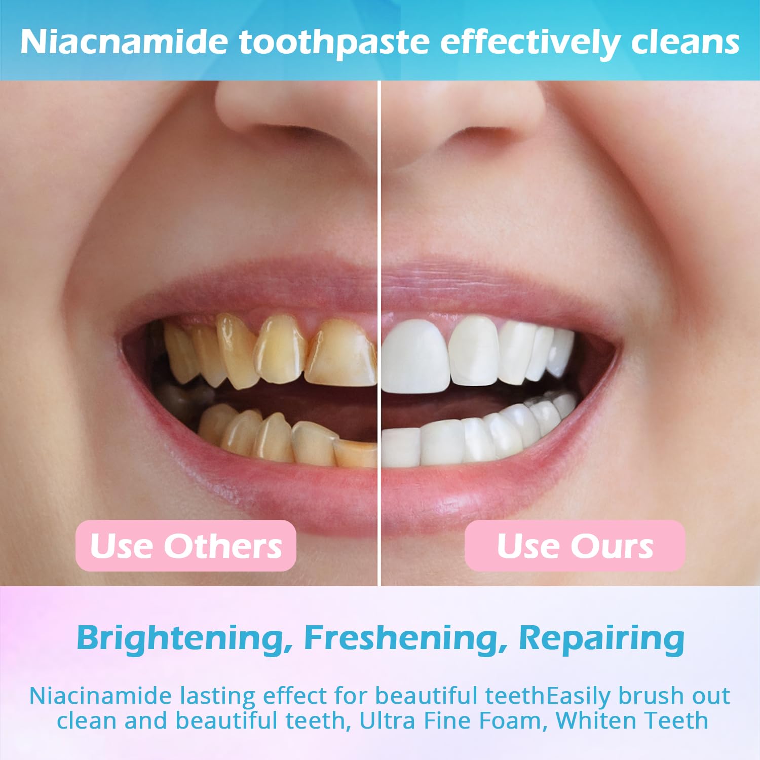 KUKSY Niacinamide nettoyage doux: nettoie sans agresser les dents sensibles.