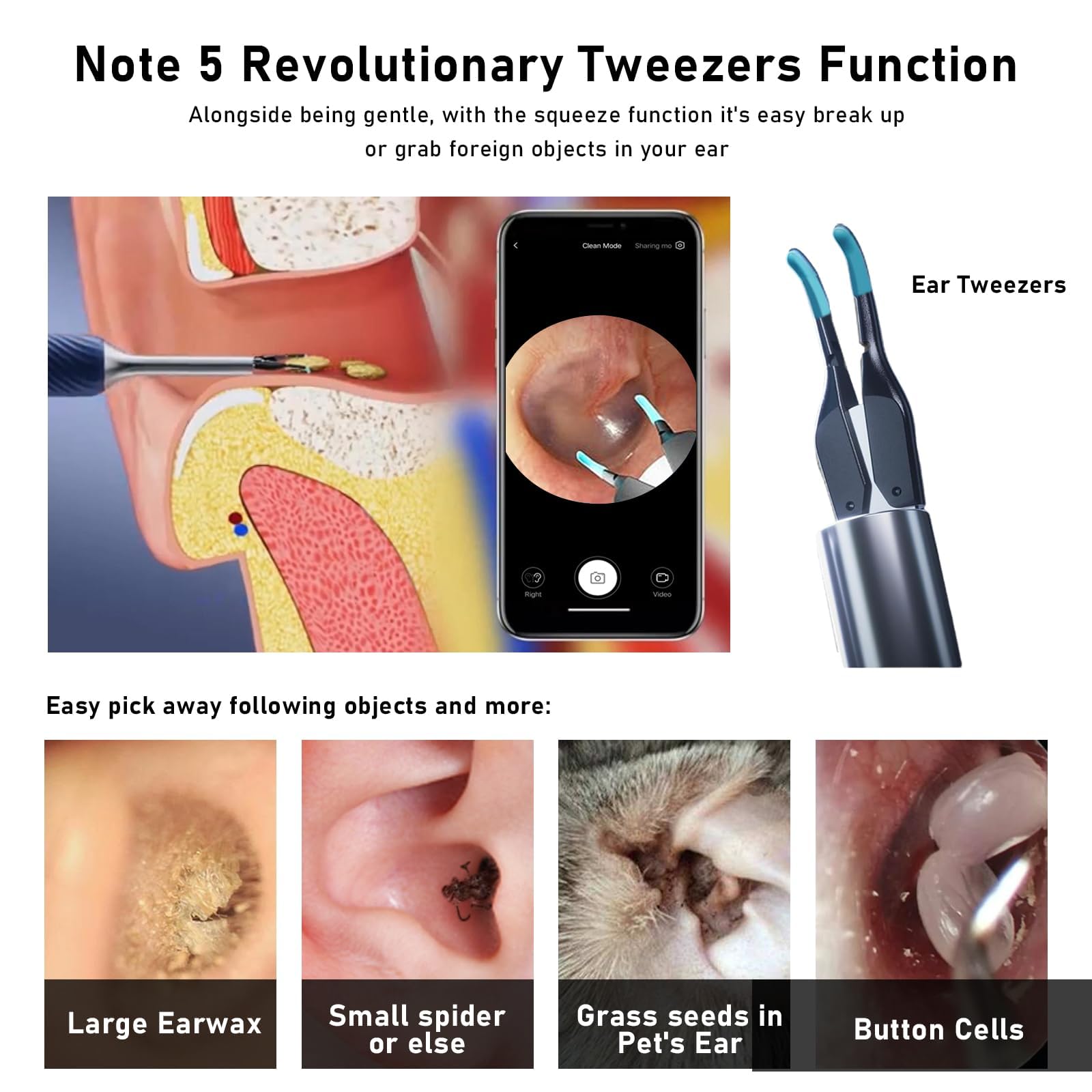 KWYBOW Note5 pince-oreille ergonomique pour retirer l’amas de cire en douceur