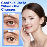 Matériau silicone doux LaseLocks hypoallergénique pour une peau respectée.