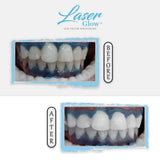 Laser Glow conseils d'entretien pour une brillance durable