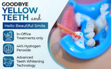Laser Glow effet durable pour un sourire plus lumineux