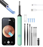 LENGIN Caméra d’otoscopie 1080p pour une inspection précise du conduit auditif.