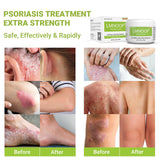 LMNOOP Psoriasis sans parfum, idéal pour peaux sensibles.