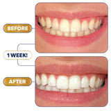 Lumineux Strips Kit – ciblage des taches café et thé pour des dents plus claires