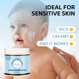 Application du produit sur la main d’un enfant dans le cadre du soin.