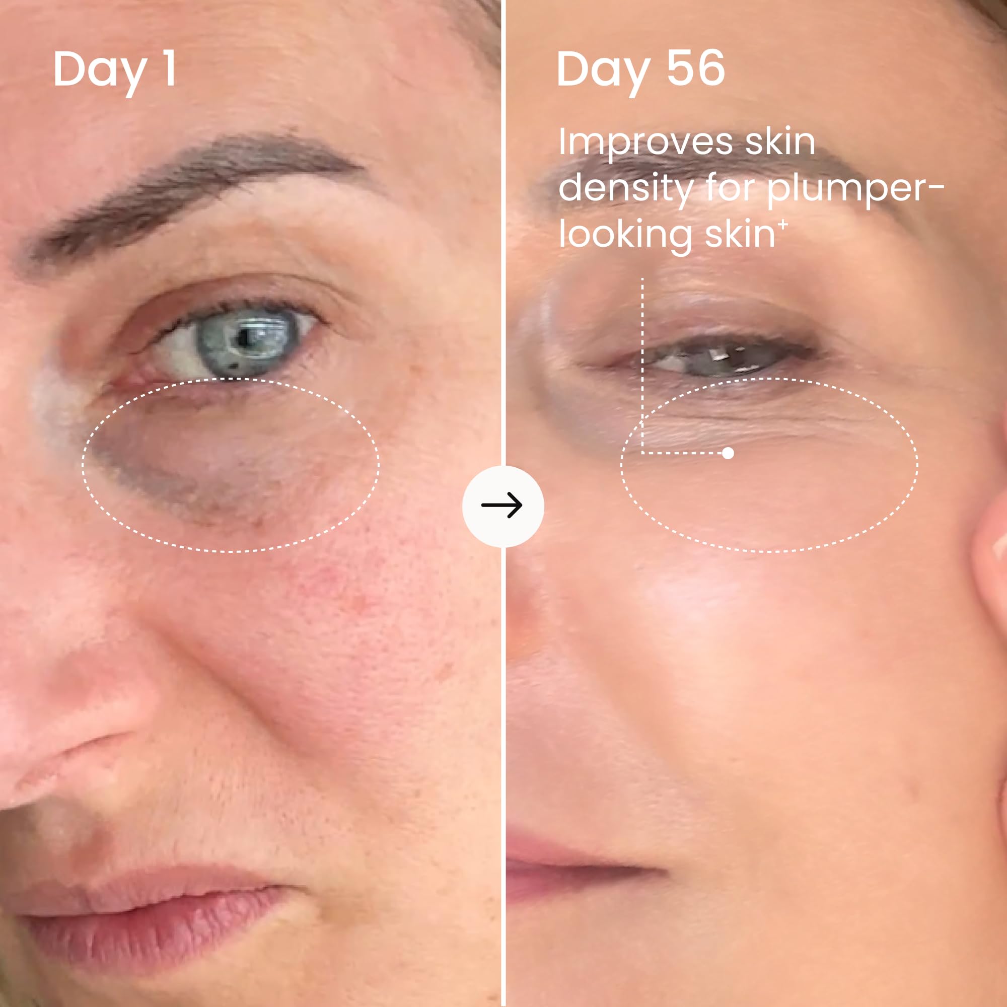 Maëlys Collagen - Biotine et vitamine C, soutien potentiel pour peau et cheveux.
