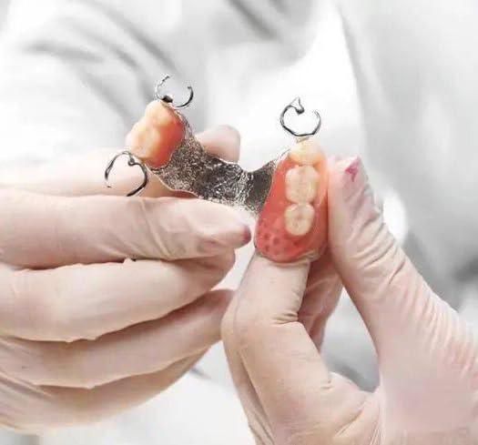 Matériau gencives-dentier-factice: réparation rapide d'un dentier temporaire.