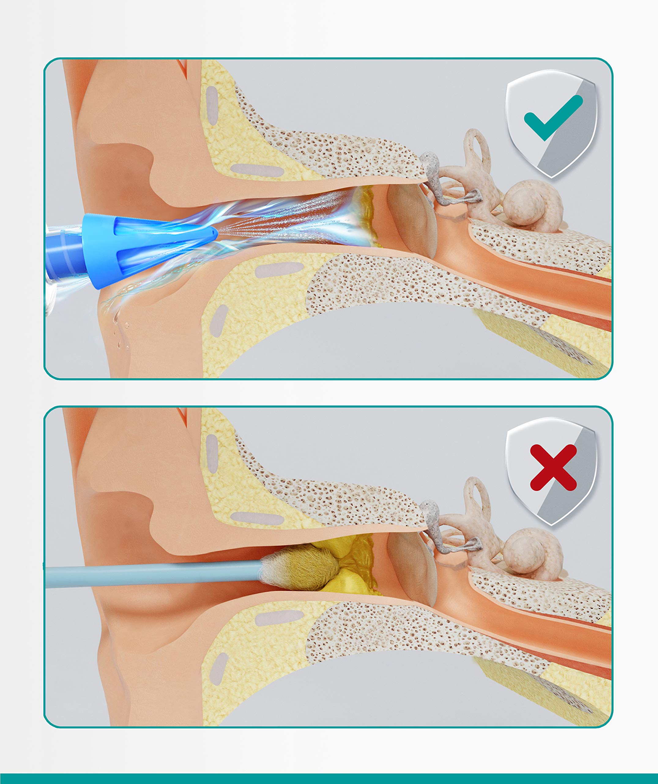 Medi Grade seringue sans BPA, outil hygiénique et sûr.