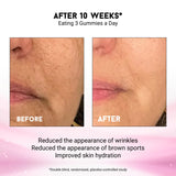 Miracle Elixir Collection Joyce Giraud Gummies – effet potentiel sur la peau et la texture.