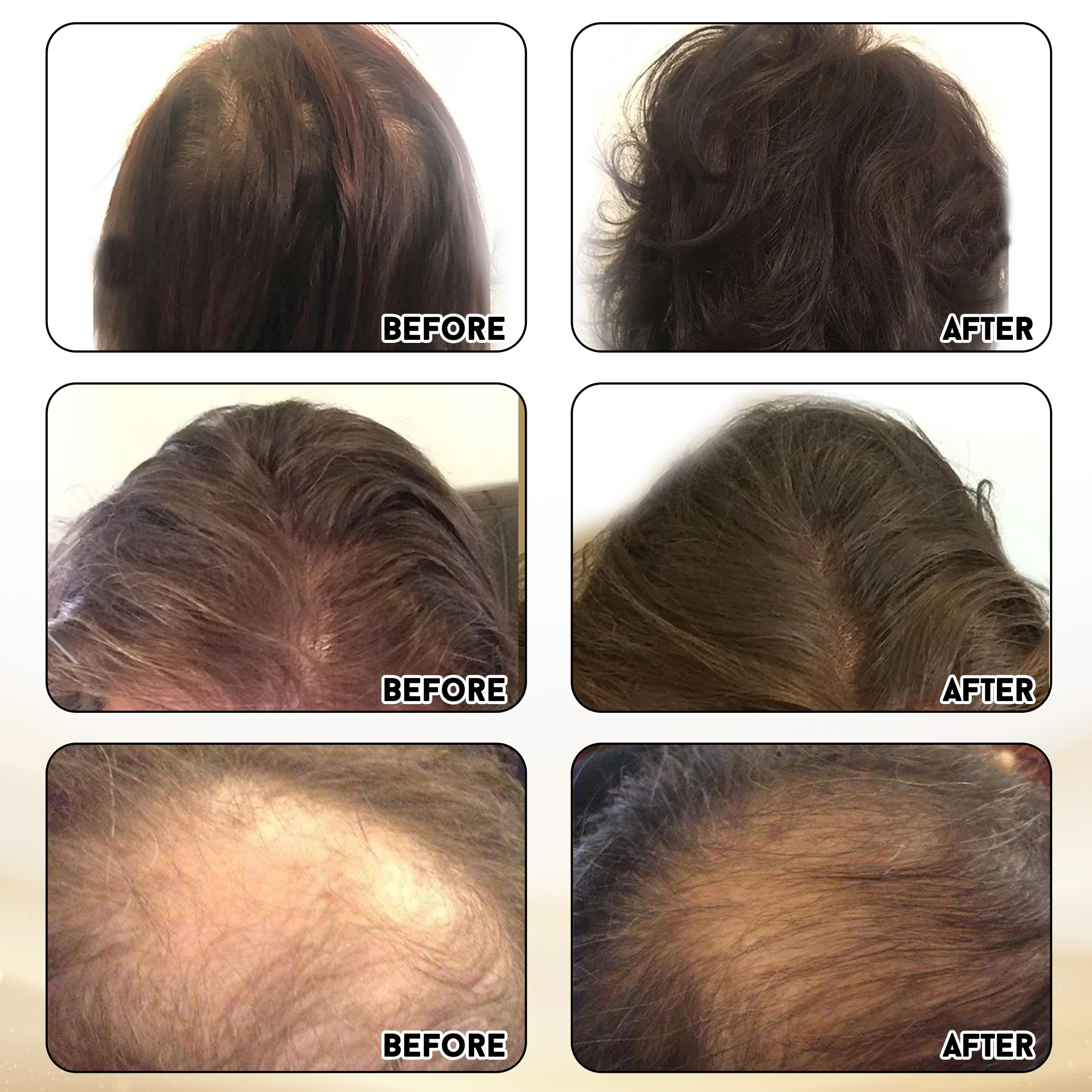 Miracle Elixir Collection – Routine d’utilisation simple pour cheveux plus forts