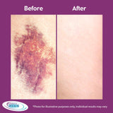 Miracle Plus Arnica Cream - Gotu Kola et collagène pour tonus.