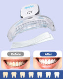 MySmile bandes blanchiment dents sans sensibilité: douceur pour gencives et émail.