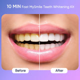 Gel éclaircissant MySmile Deluxe 35% carbamide, formule douce et efficace.