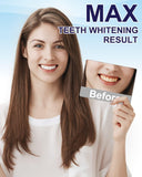 MySmile Formule douce adaptée aux dents sensibles et gencives.