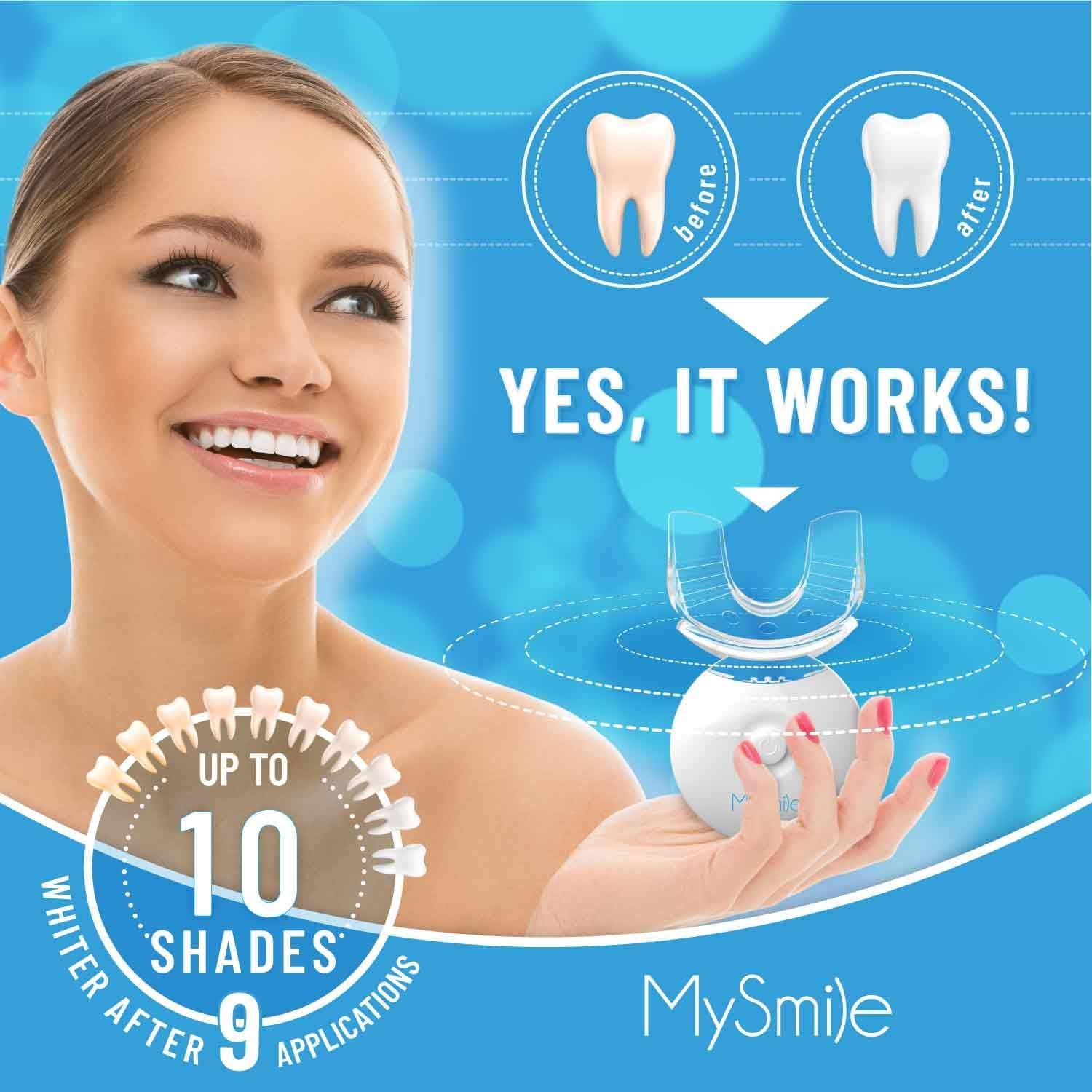 MySmile gel blanchiment 3 carbamide pour des résultats visibles