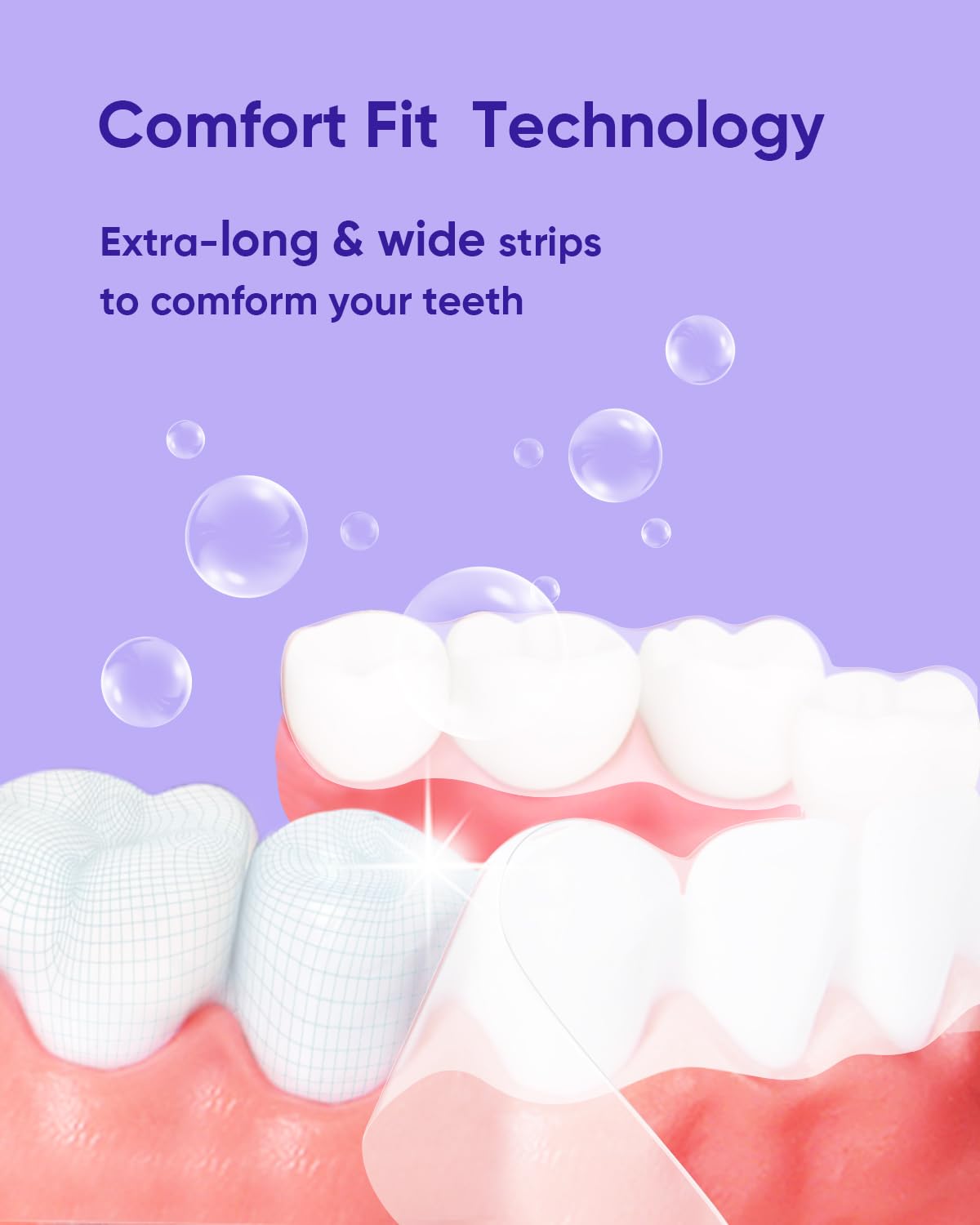MySmile Kit blanchiment à domicile : solution pratique et économique pour un sourire plus clair.