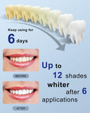 MySmile lampe IPX7 étanche: utilisation fiable et propre.