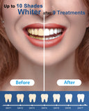 MySmile refills 60 traitements potentiels pour sourire éclatant
