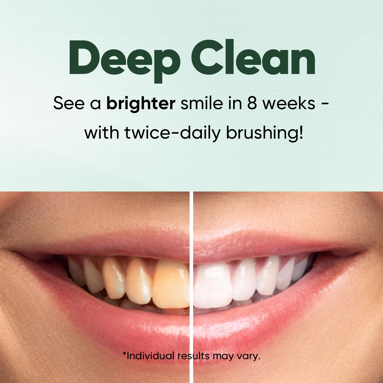MySmile: remineralisation de l’émail pour une surface plus lisse.