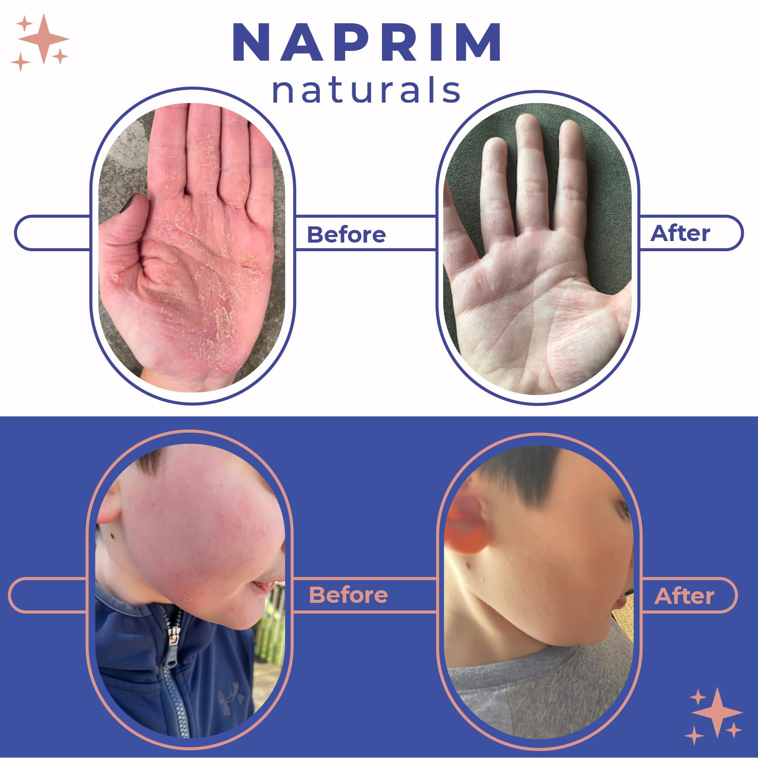 Naprim Naturals Poudre Nourrissante — texture fine et absorption rapide