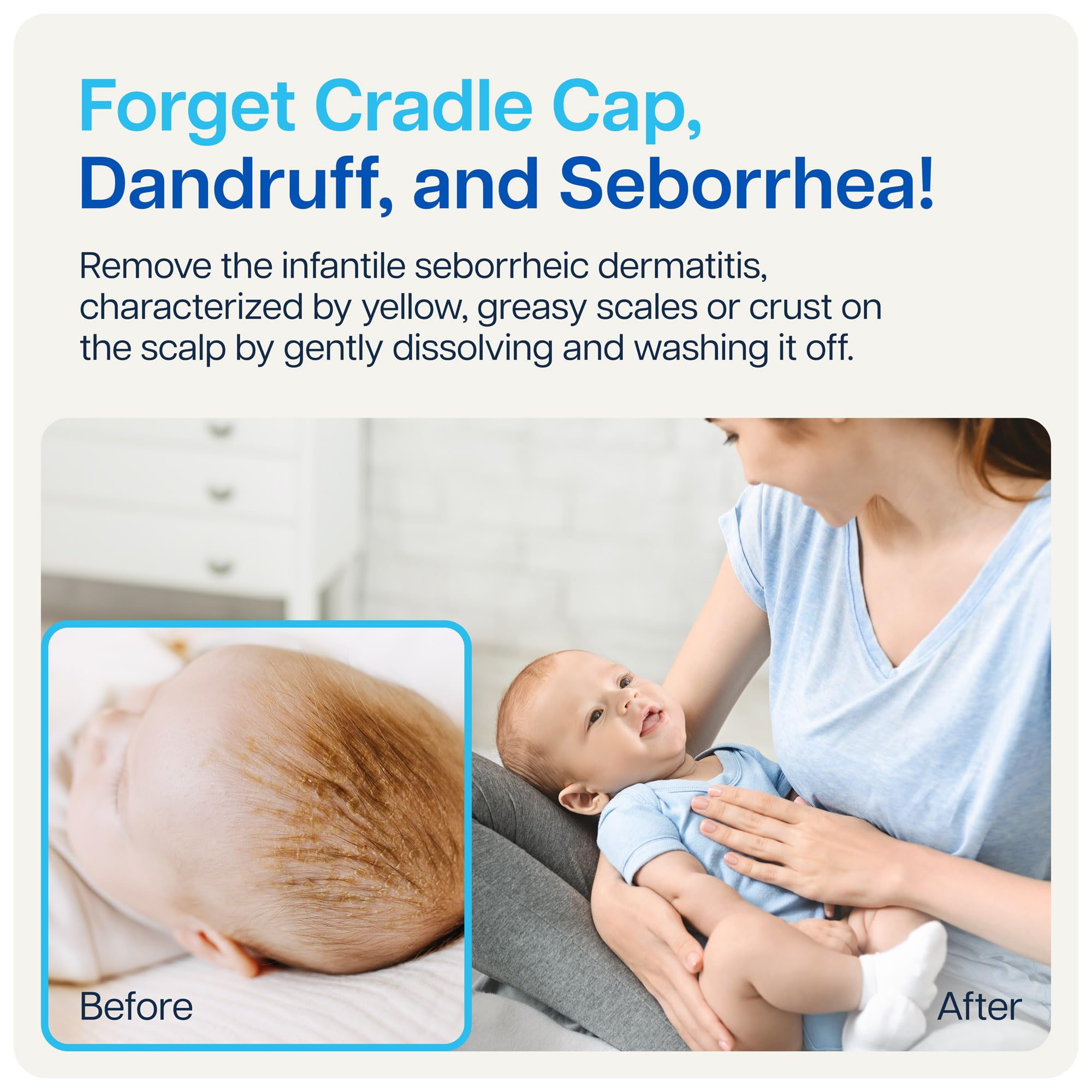 NAVEH PHARMA Cradle Cap Cleanser: sécurité adaptée dès le premier jour