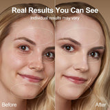 NeatLt – forme dauphin pour massage précis du visage.