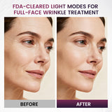 Novurial nettoyage facile en silicone, hygiène quotidienne simplifiée.