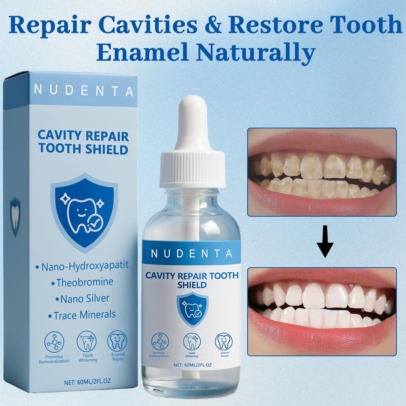 NUDENTA Odontic Repair – emballage extérieur idéal pour une utilisation à domicile.