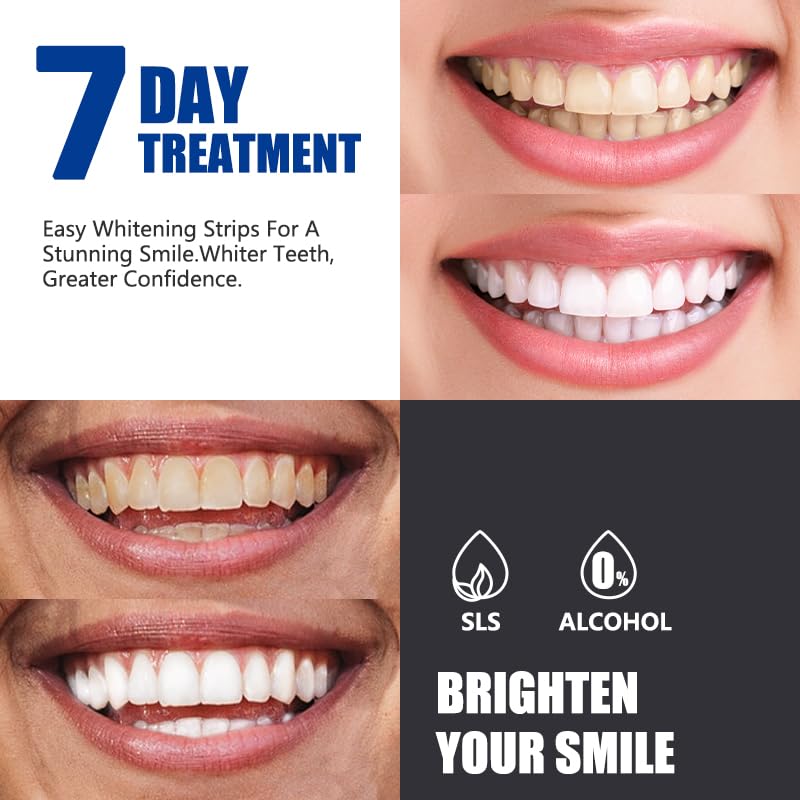 OHOO Bandes blanchiment menthe - adhésion efficace sur les dents
