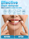 OLL M-led-bleu-rouge: lumière LED couvrant l’ensemble des dents.