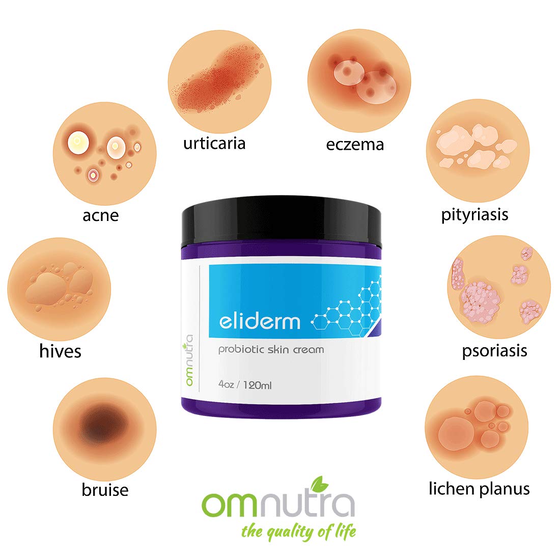 OmNutra crème probiotique pieds – anti-fongique et réconfort après la journée.