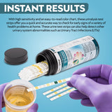 One Step 10A couvre 10 paramètres d’urinalyse pour une vue d’ensemble