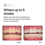 Opalescence 20% : gouttiere invisalign compatibles pour utilisation pratique.